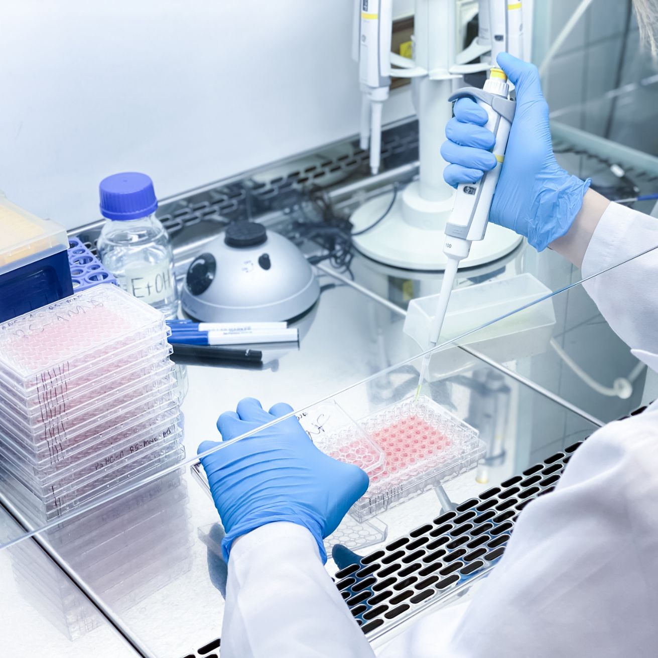 metabolomics data processing